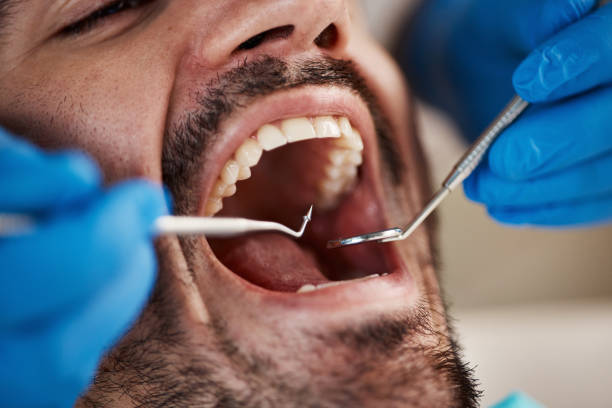 Best Dentist for Dental Trauma  in Middleburg Heights, OH