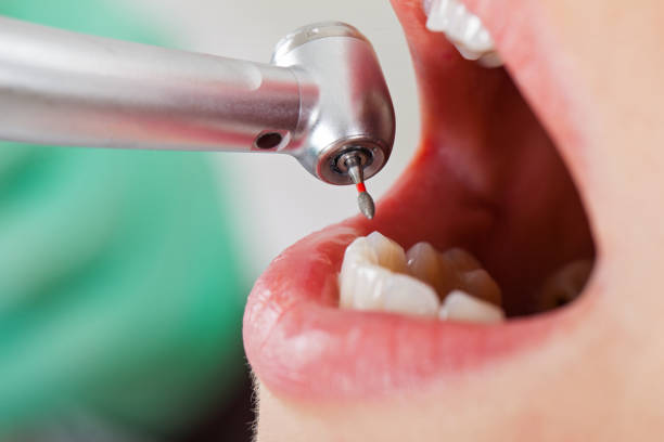 Best Cracked Tooth Emergency Dentist  in Middleburg Heights, OH